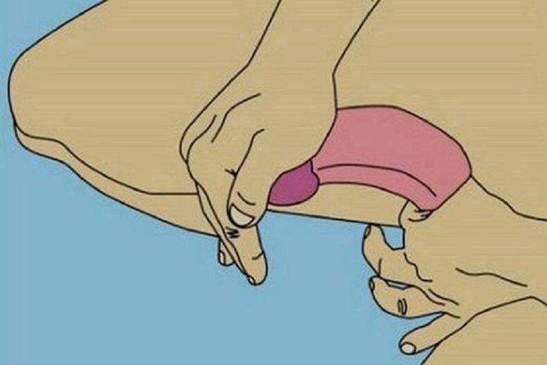 Flexión para a ampliación do pene