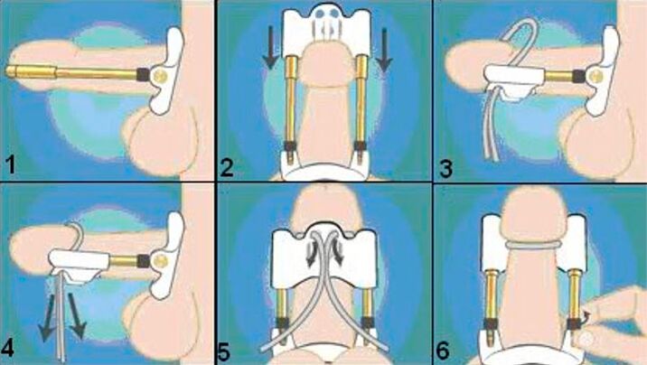 A tecnoloxía final