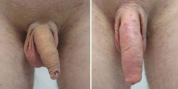 Pene antes e despois de colgar pesas
